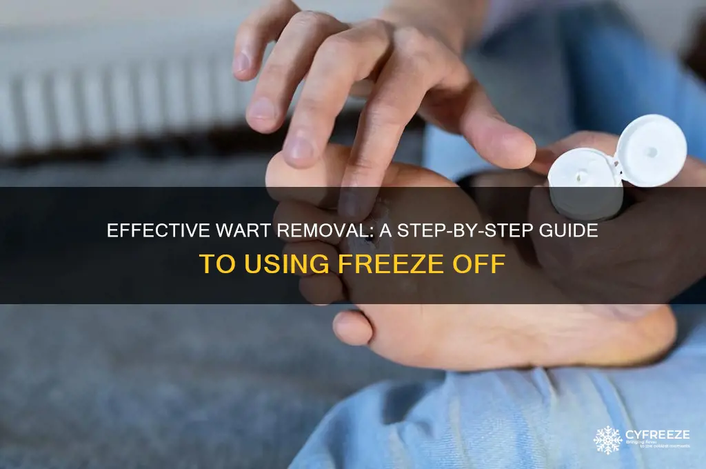 how to use freeze off wart remover