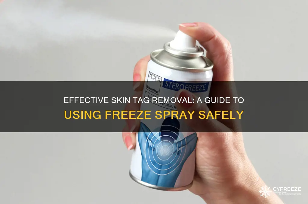 how to use freeze spray on skin tags