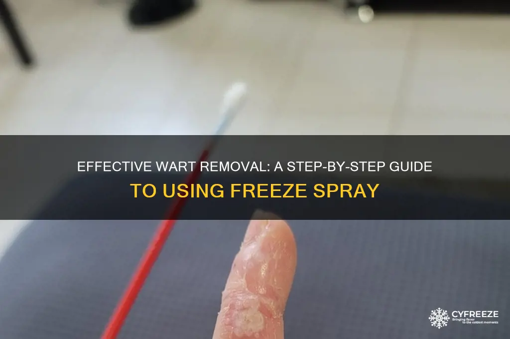 how to use freeze spray on warts