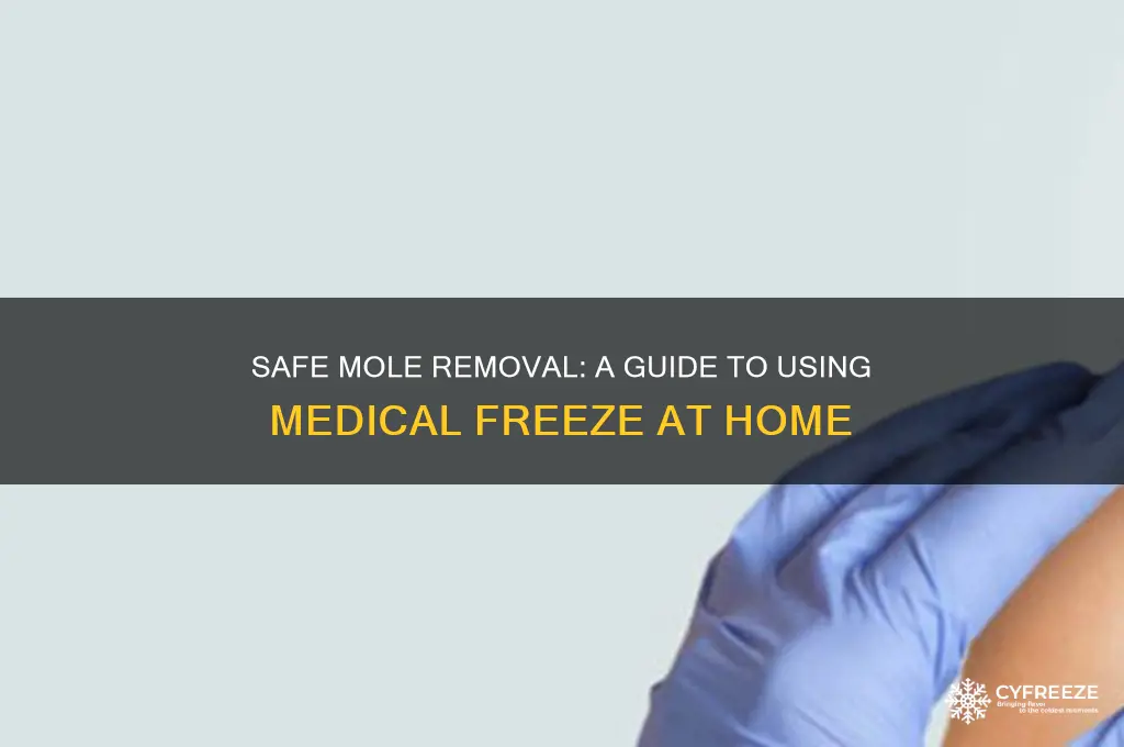 how to use medical freeze on mole