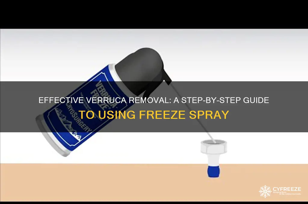 how to use verruca freeze spray