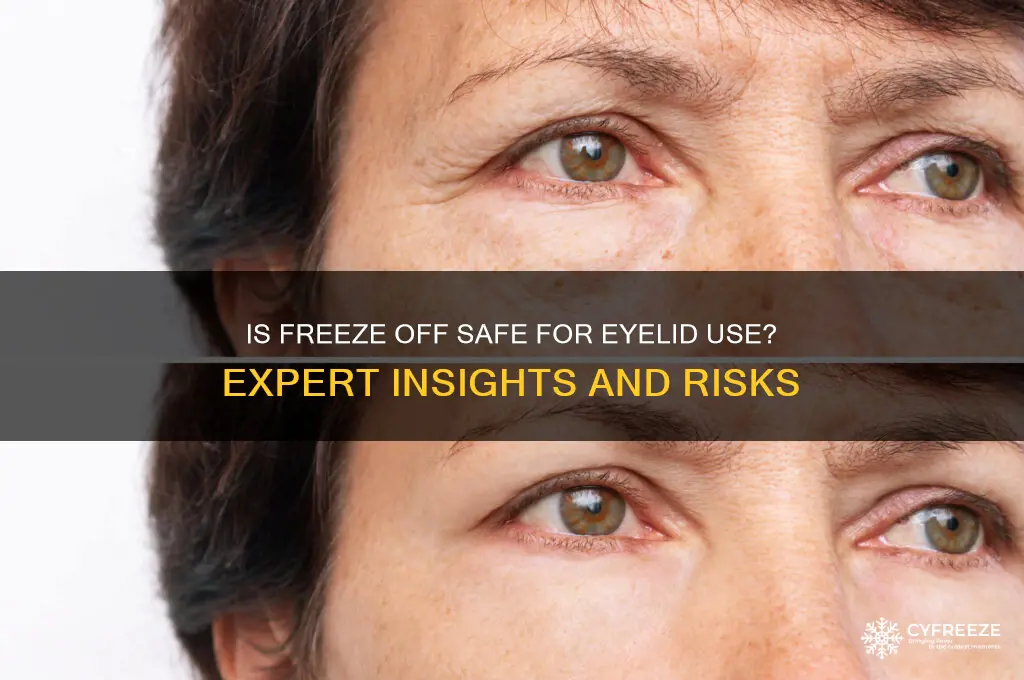 is it safe to use freeze off on eye lid