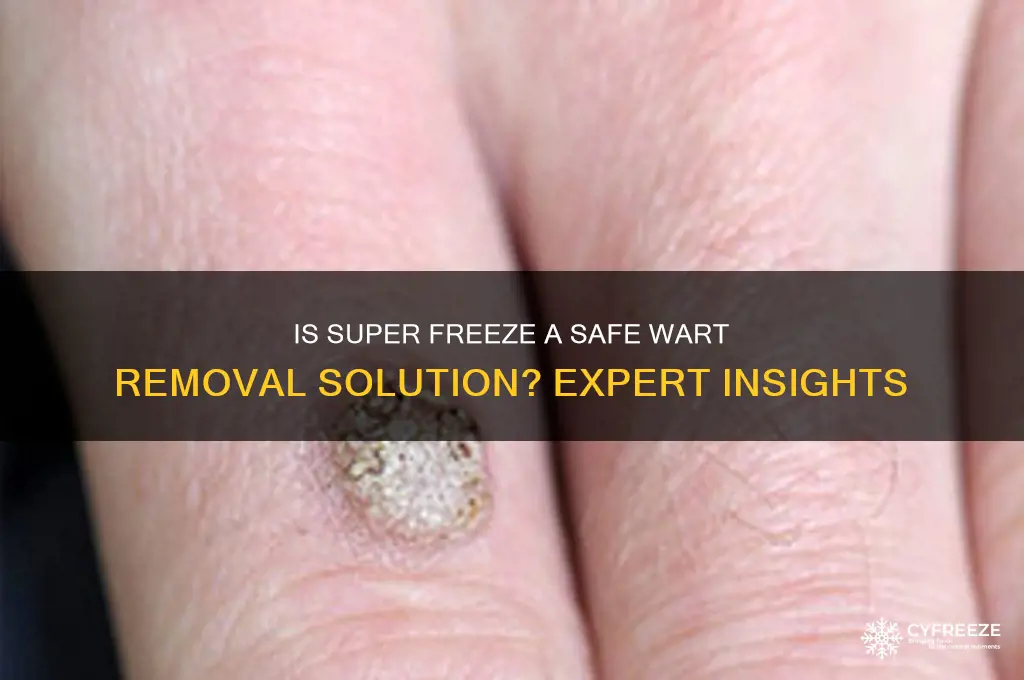 is super freeze safe to use on warts