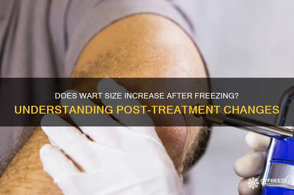 is the wart supposes to get biggger after freezing it