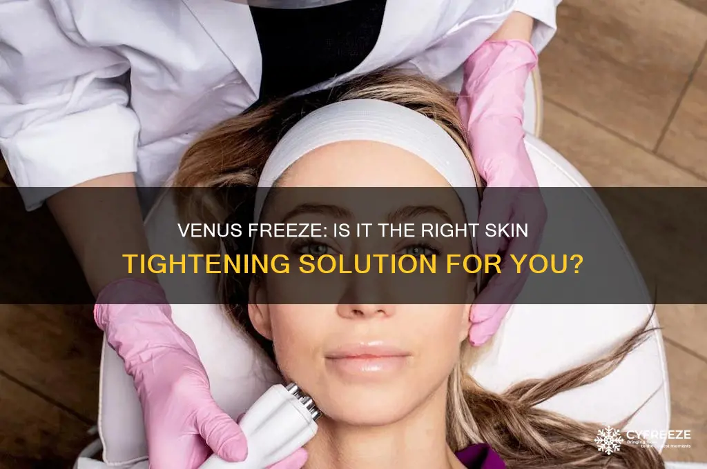 should i get venus freeze