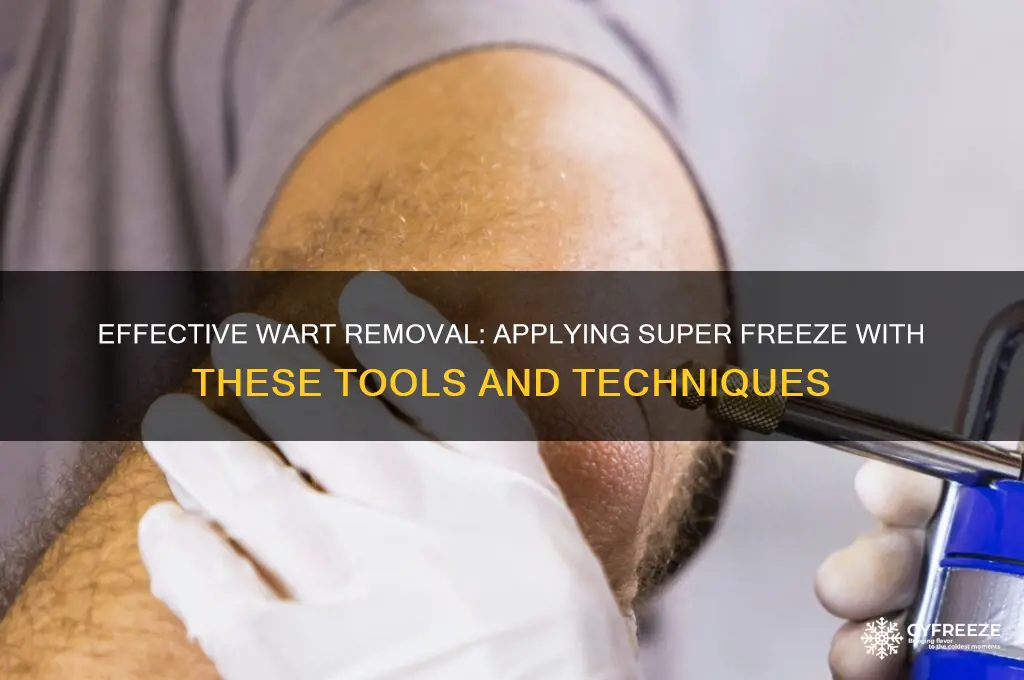what can be used to apply super freeze to warts