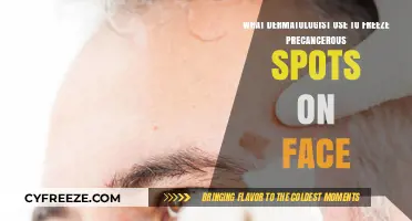 Cryotherapy: How Dermatologists Freeze Precancerous Facial Spots Effectively