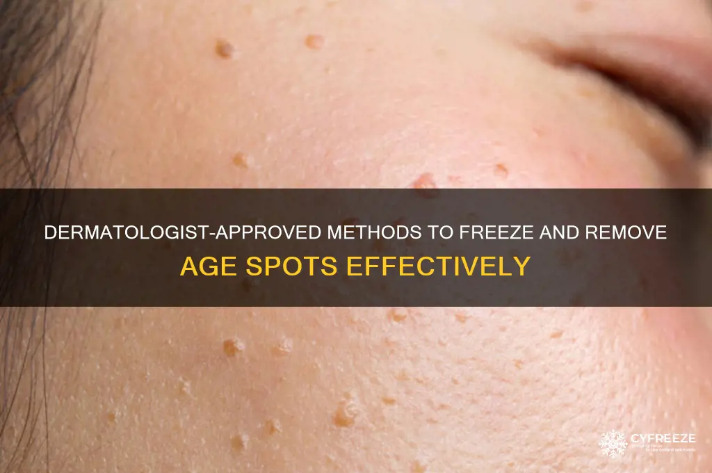 what do dermatologist use to freeze age spots