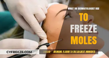 Dermatologist's Secret: Freezing Moles with Cryotherapy Explained
