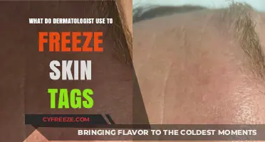 Dermatologist-Approved Methods: Freezing Skin Tags Safely and Effectively