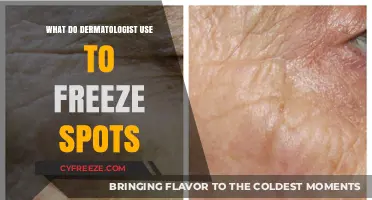 Dermatologist's Secret: Freezing Skin Spots with Cryotherapy Explained