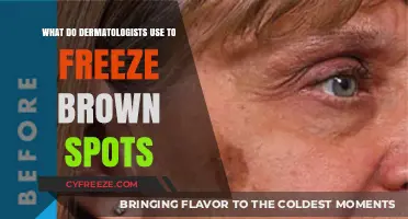 Dermatologists' Secret: Freezing Brown Spots with Cryotherapy Explained