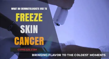 Cryotherapy: How Dermatologists Freeze Skin Cancer with Liquid Nitrogen