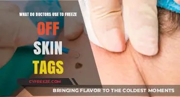 Effective Methods: What Do Doctors Use to Freeze Off Skin Tags?