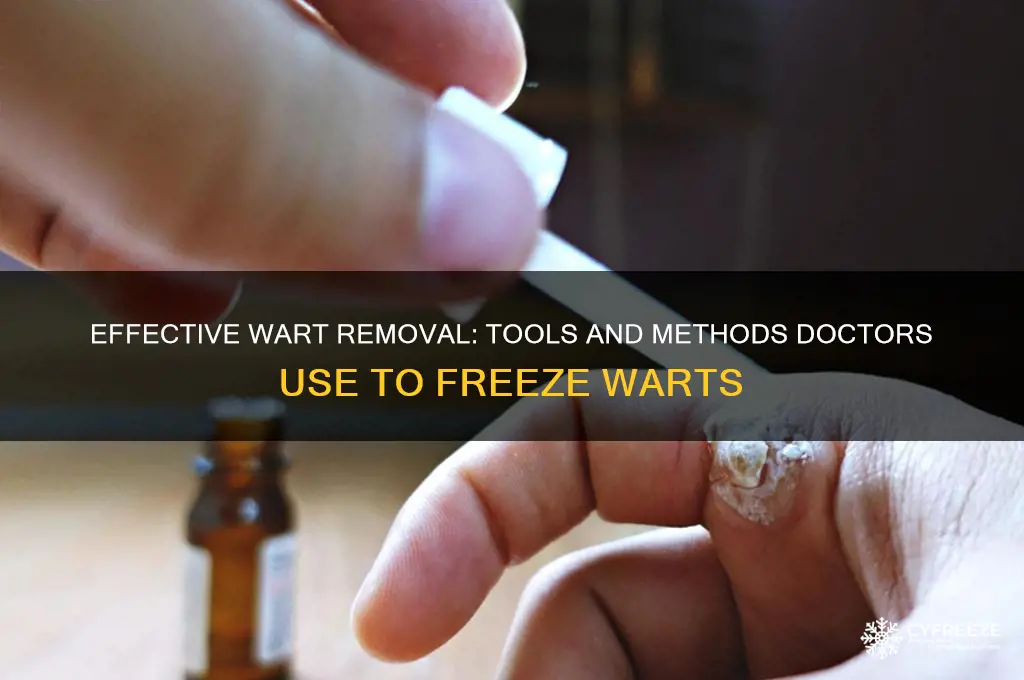 what do dr use to freeze warts