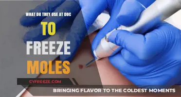 What Do They Use at the Doctor's Office to Freeze Moles?