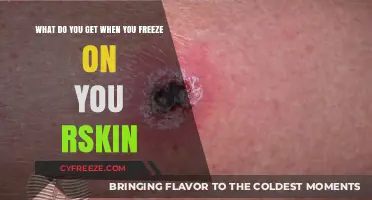Freezing Skin Effects: Understanding What Happens When You Freeze Your Skin