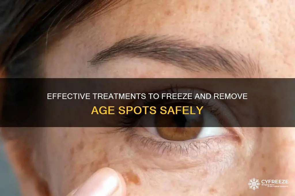 what do you use to freeze age spots