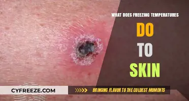 How Freezing Temperatures Affect Skin: Risks, Damage, and Prevention Tips