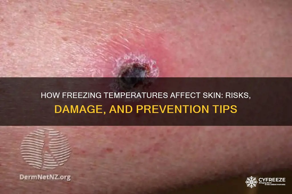 what does freezing temperatures do to skin
