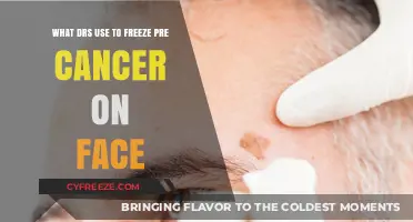 Cryotherapy: How Dermatologists Freeze Precancerous Lesions on the Face