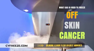 Cryotherapy for Skin Cancer: The Role of Liquid Nitrogen in Treatment