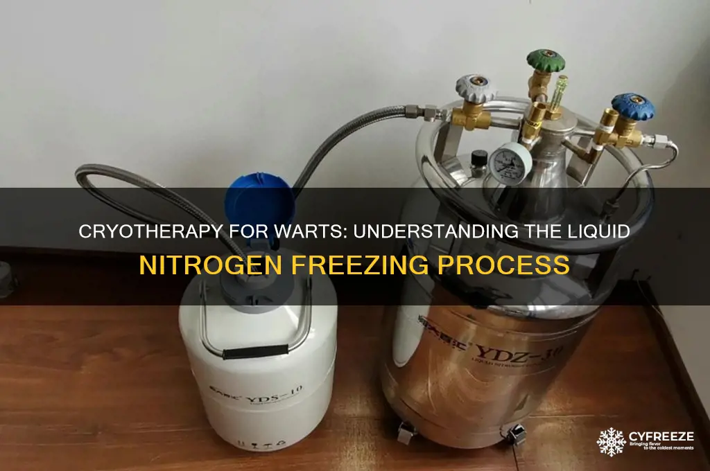 what gas is used to freeze warts