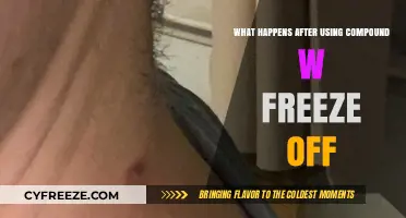 Post-Treatment Insights: What to Expect After Using Compound W Freeze Off