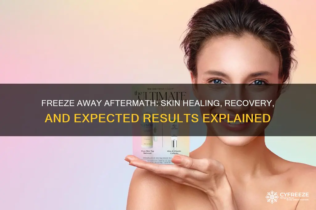 what happens after using freeze away