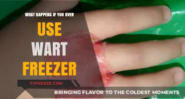 Overusing Wart Freezer: Risks, Side Effects, and Safe Application Tips