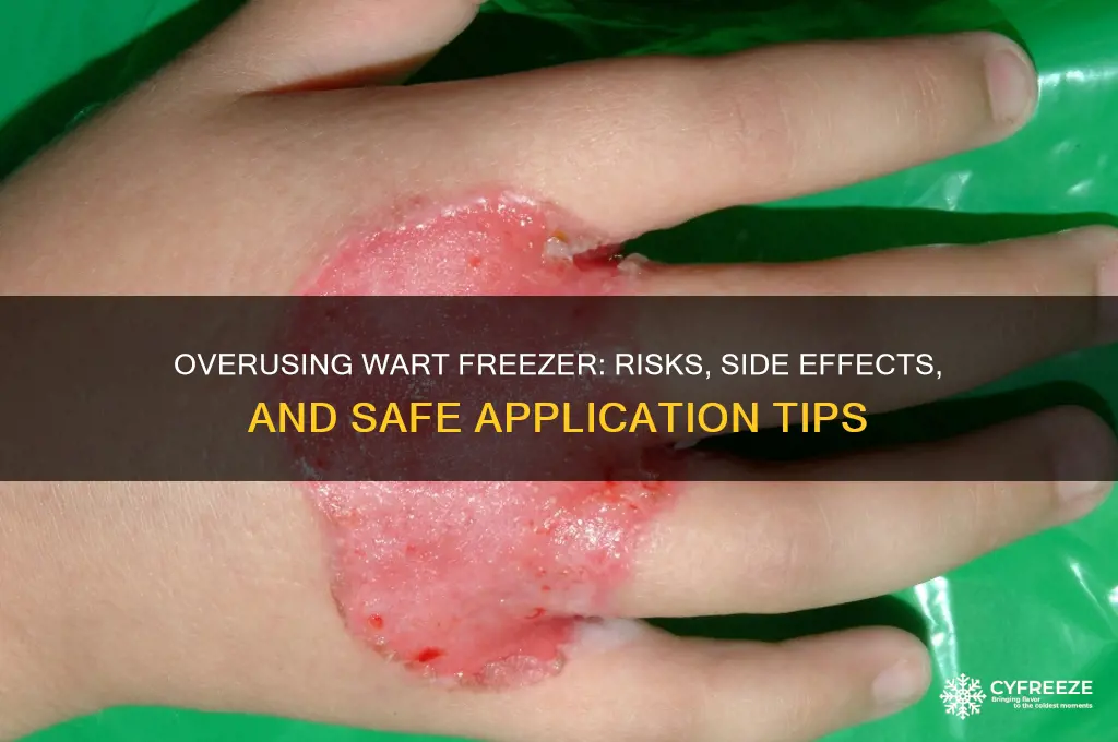 what happens if you over use wart freezer
