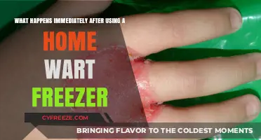 Post-Freezing Wart Removal: Immediate Effects and What to Expect at Home