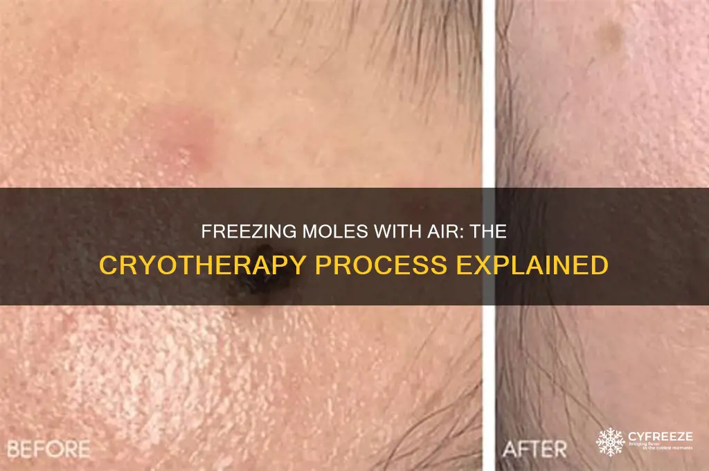 what happens when they use air to freeze a mole