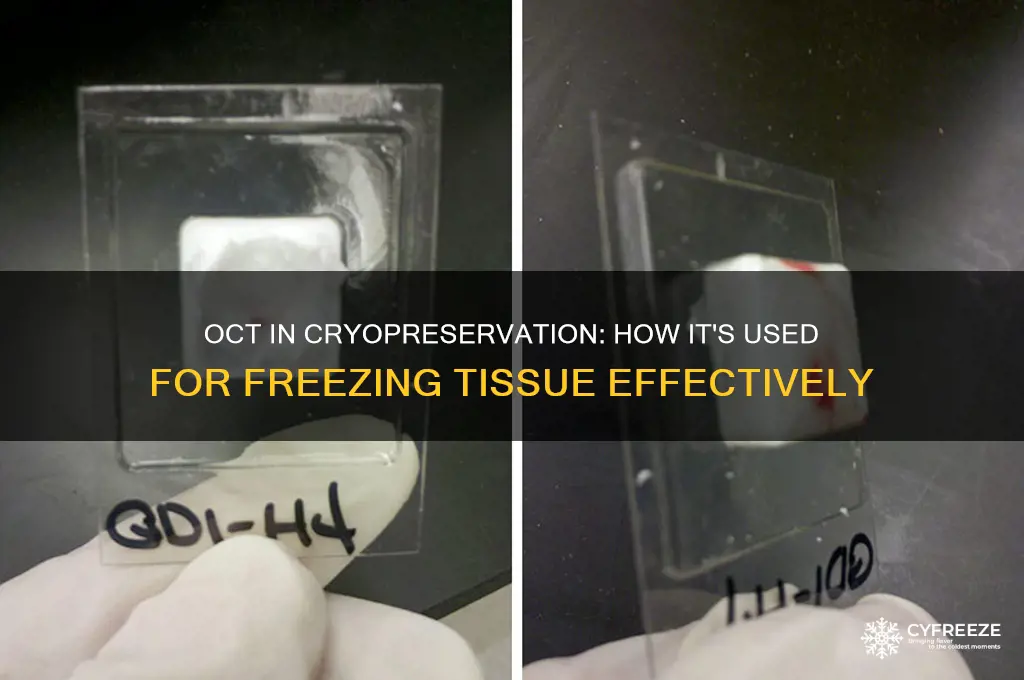 what is oct used for freezing tissue