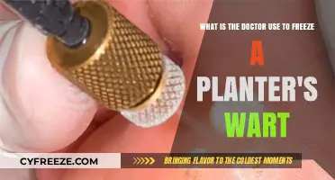 Freezing Planter's Warts: The Doctor's Preferred Treatment Method Explained