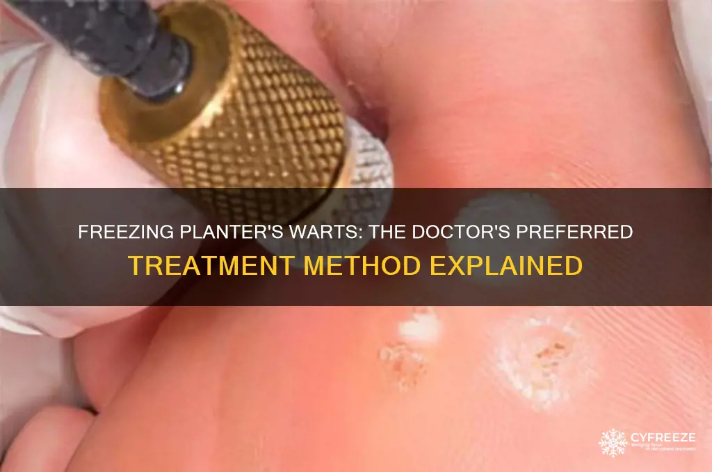 what is the doctor use to freeze a planter