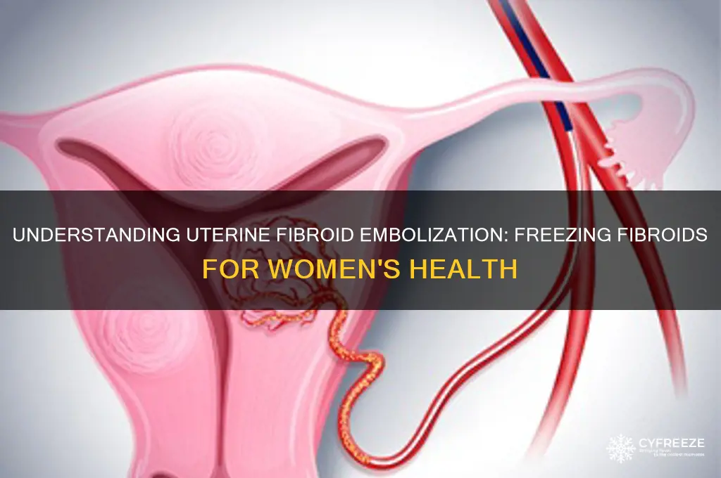 what is the procedure called when women get fibroids freezed