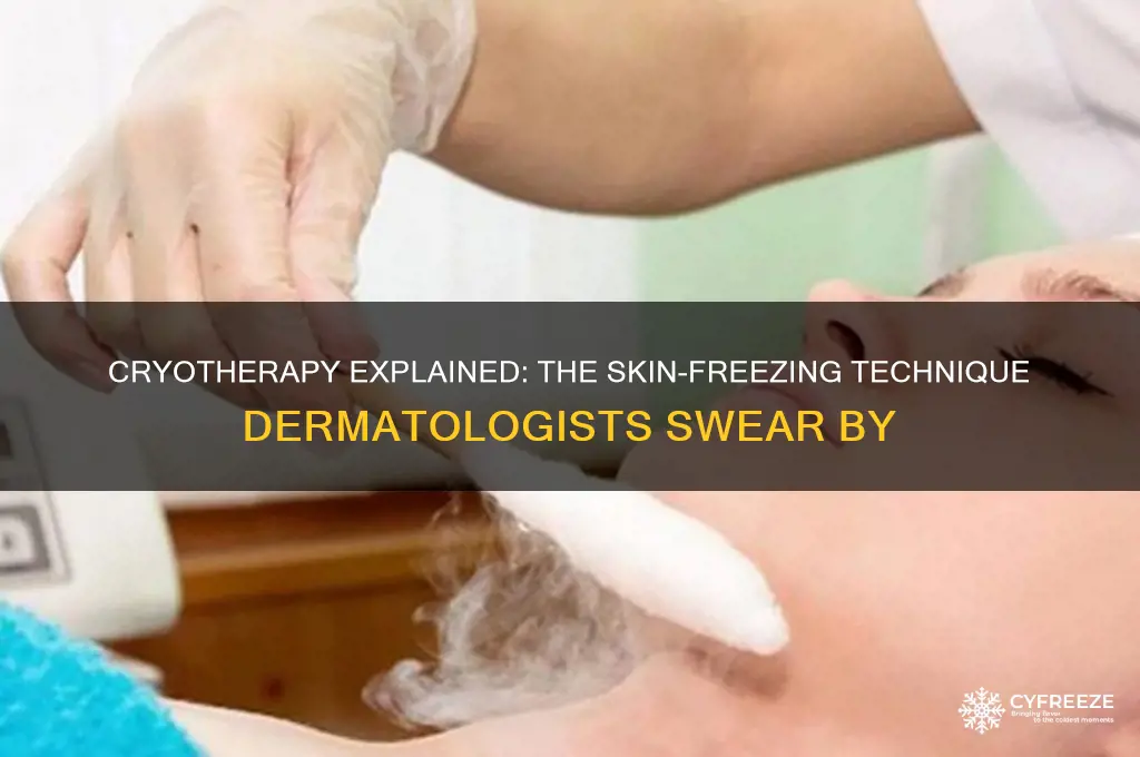 what is the stuff dermatologists use to freeze skin