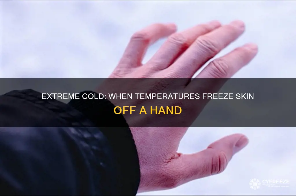 what is the temperature freezes skin off a hand
