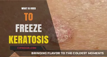 Effective Treatments to Freeze Keratosis: Methods and Applications Explained