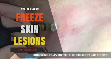Cryotherapy: The Ultimate Skin Lesion Freezing Treatment Explained