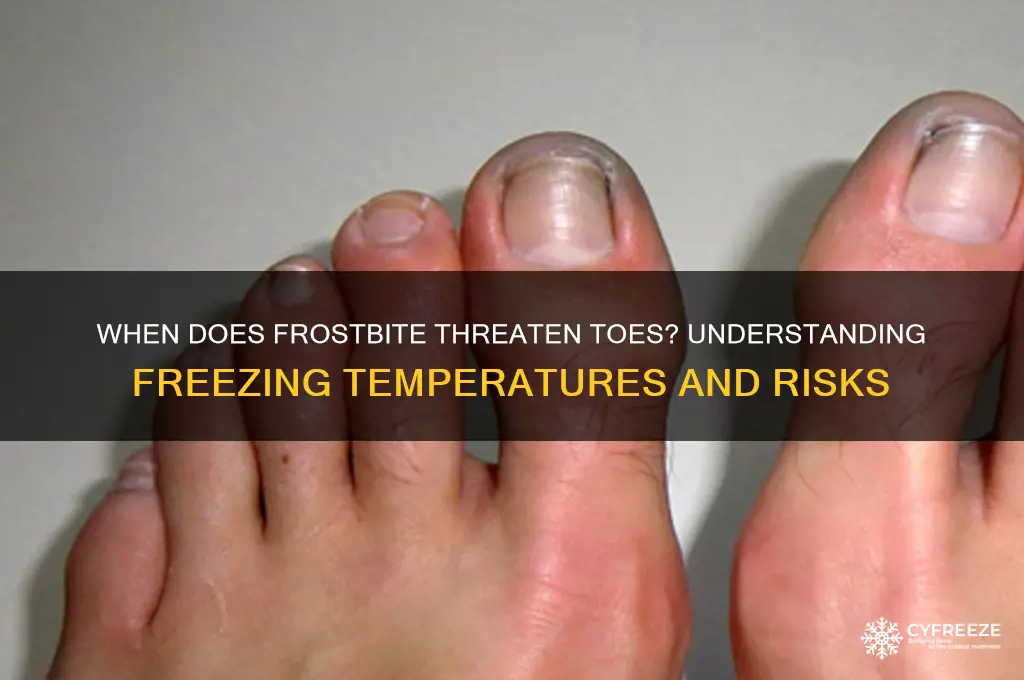what temperature before toes start freezing off