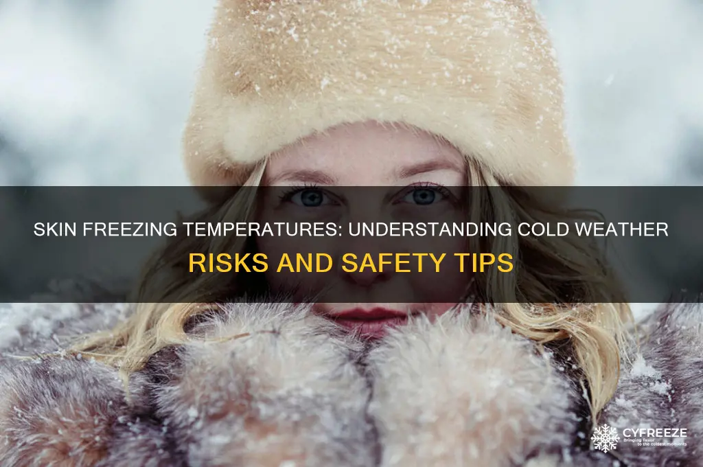 what temperature can skin freeze