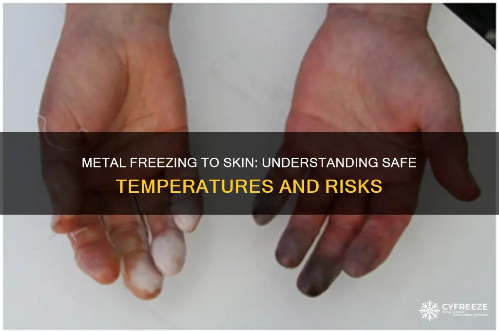 what temperature does metal freeze to skin