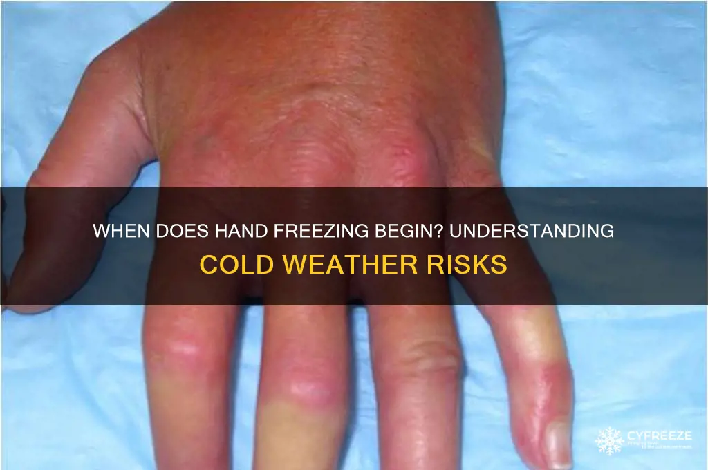 what temperature does my hand start freezing