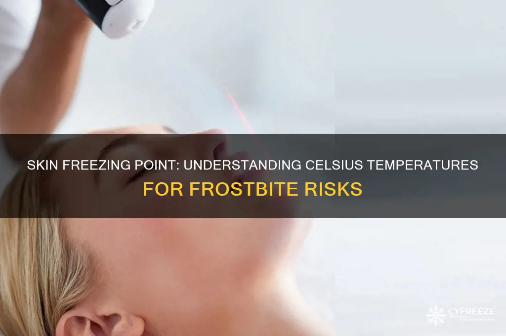 what temperature does skin freeze celsius