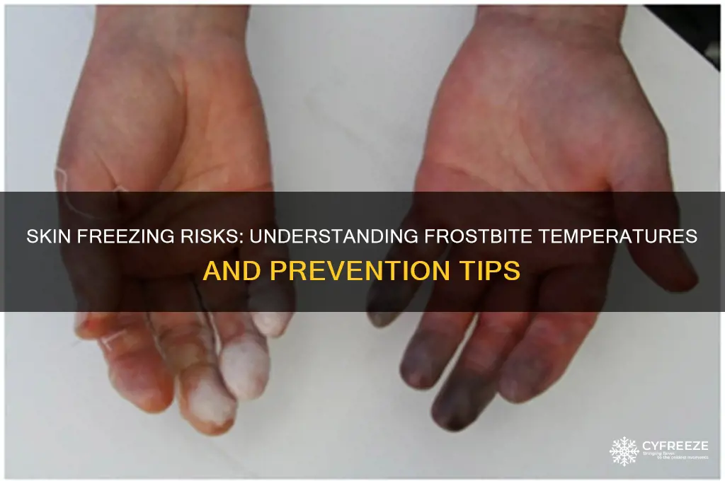 what temperature does skin freeze on contact