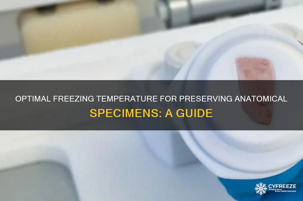 what temperature is ideal for freezing anatomical specimens