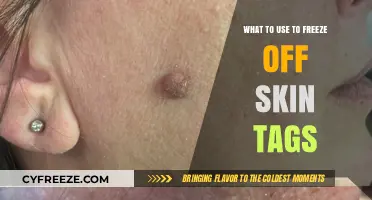 Effective Methods to Freeze Off Skin Tags Safely at Home