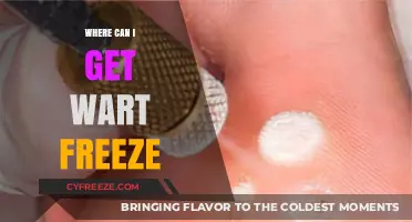 Effective Wart Freeze Treatment Options: Where to Find Relief Fast